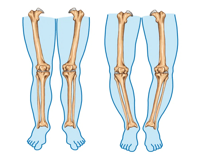 Knee belt